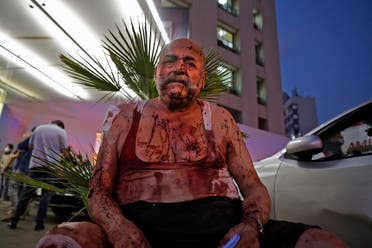 A wounded man receives help outside a hospital following an explosion in the Lebanese capital Beirut on August 4, 2020. (AFP) 