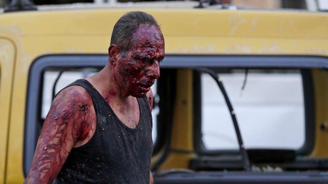 A wounded man walks at the port near the scene of an explosion in the Lebanese capital Beirut. (AFP)