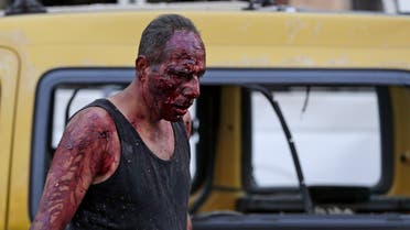 A wounded man walks at the port near the scene of an explosion in the Lebanese capital Beirut. (AFP)
