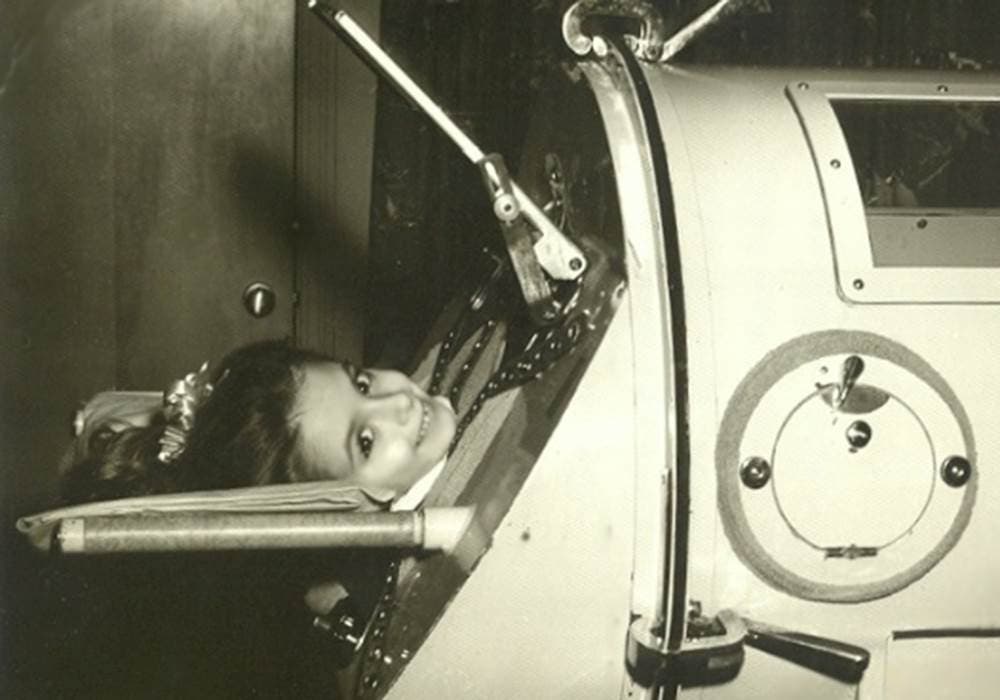 صورة لطفلة مصابة بالشلل أثناء تواجدها داخل آلة الرئة الحديدية