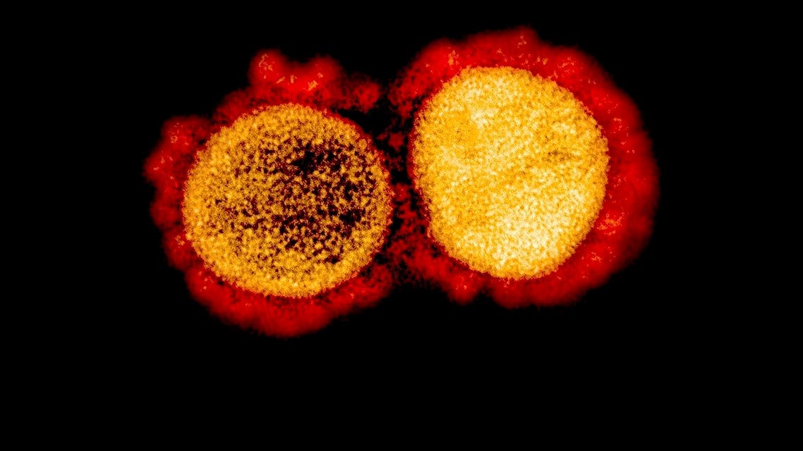 This undated image obtained Aug. 11, 2020, courtesy of the National Institute of Allergy and Infectious Diseases(NIH/NIAID), shows a transmission electron micrograph of SARS-CoV-2 virus particles, isolated from a patient, captured and color-enhanced at the NIAID Integrated Research Facility (IRF) in Fort Detrick, Maryland. (AFP)
