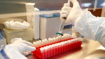 Coronavirus: Russia to register second COVID-19 vaccine by October