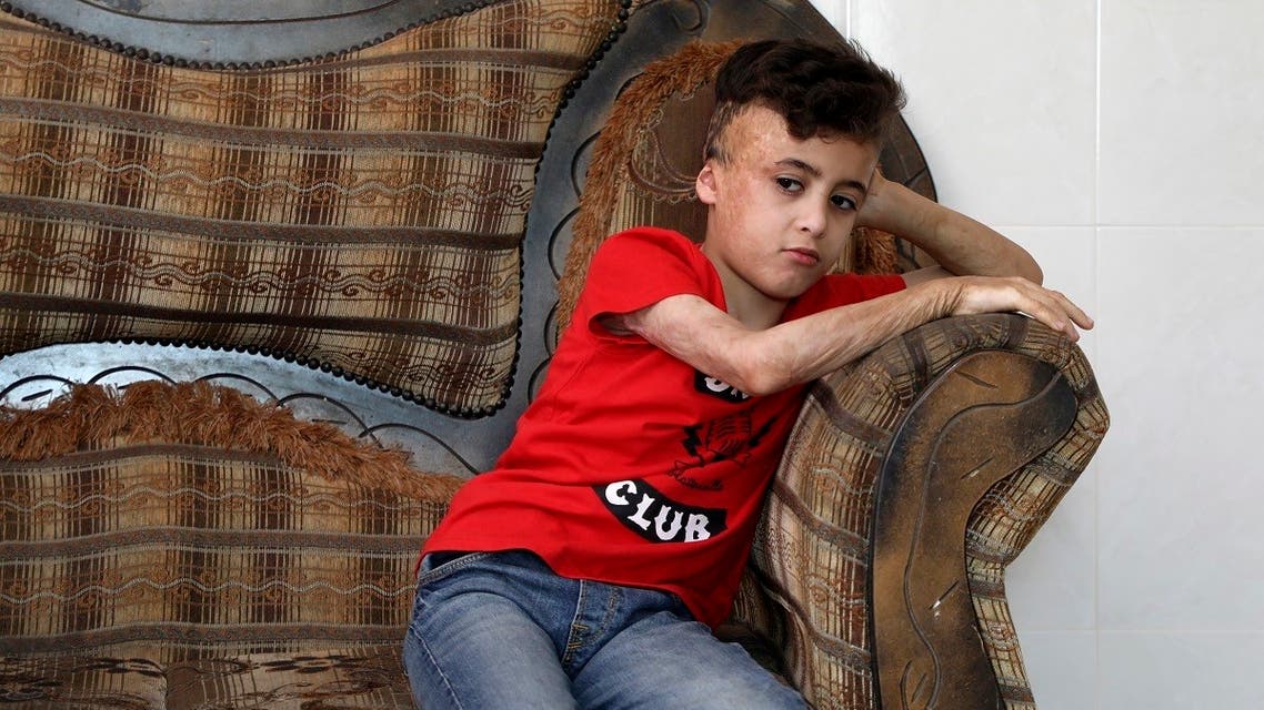 Ahmed Dawabsha, the survivor of the arson attack by Jewish extremists who killed his parents and 18-month-old brother, sits in his grand-parent home in the Israeli occupied West Bank village of Duma on May 18, 2020. (AFP)