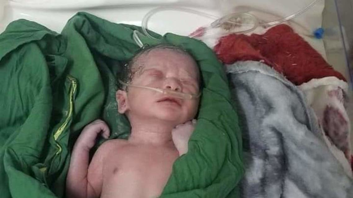 الطفل جهاد بعد انقاذه بعملية قيصريه