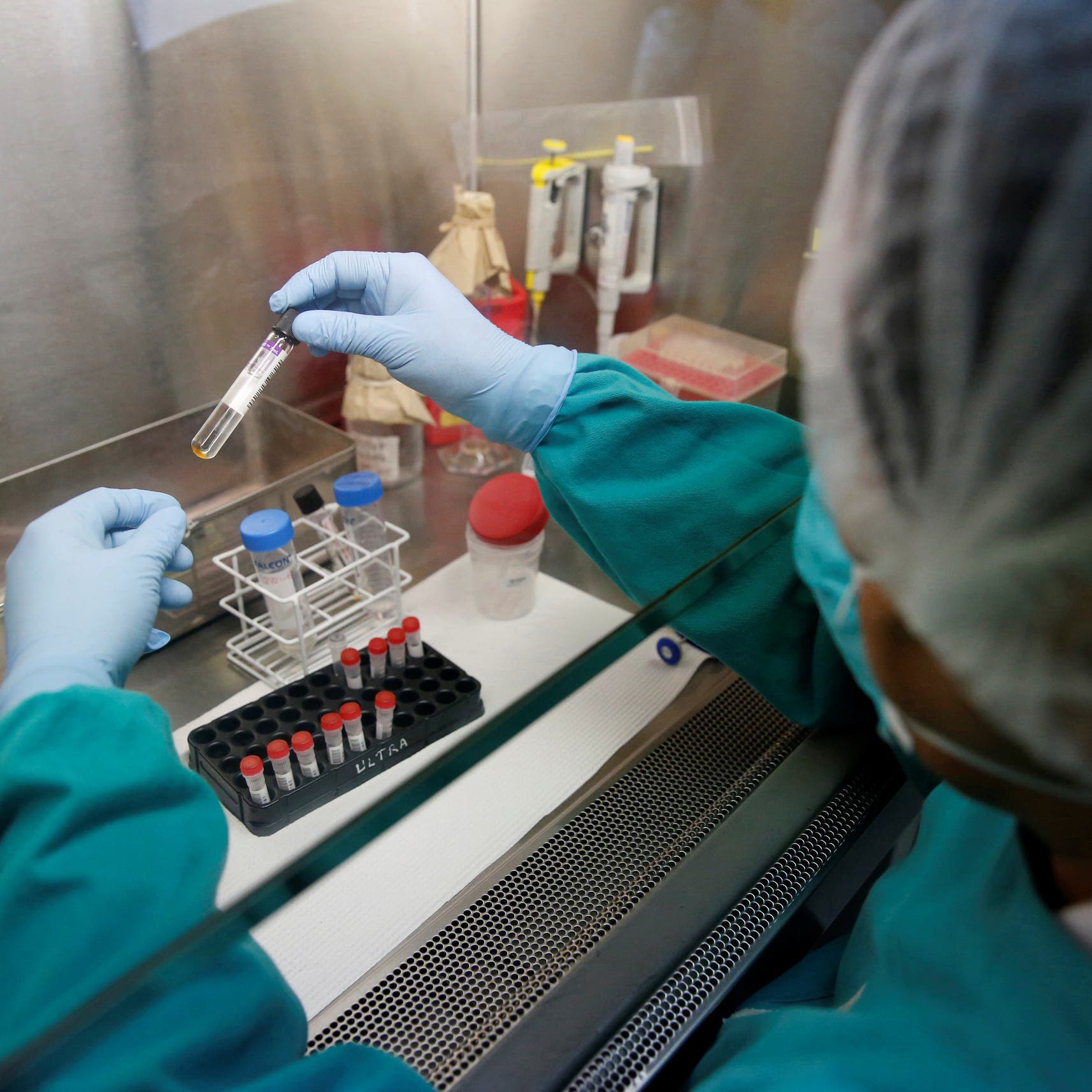 وباء كورونا يرجع بجهود مكافحة السل 8 سنوات للوراء