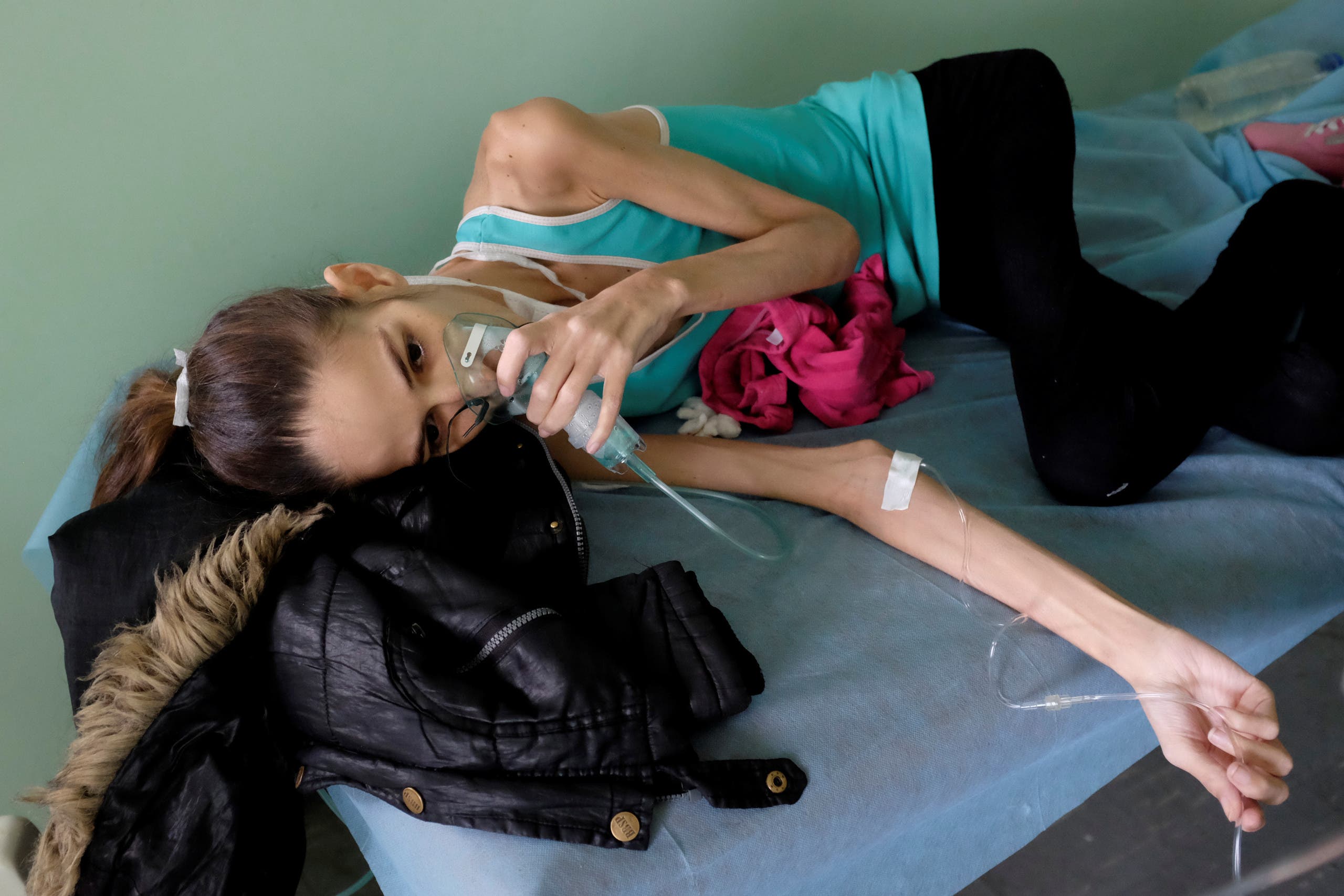 مصابة بكورونا ونقص المناعة في احد مستشفيات فنزويلا