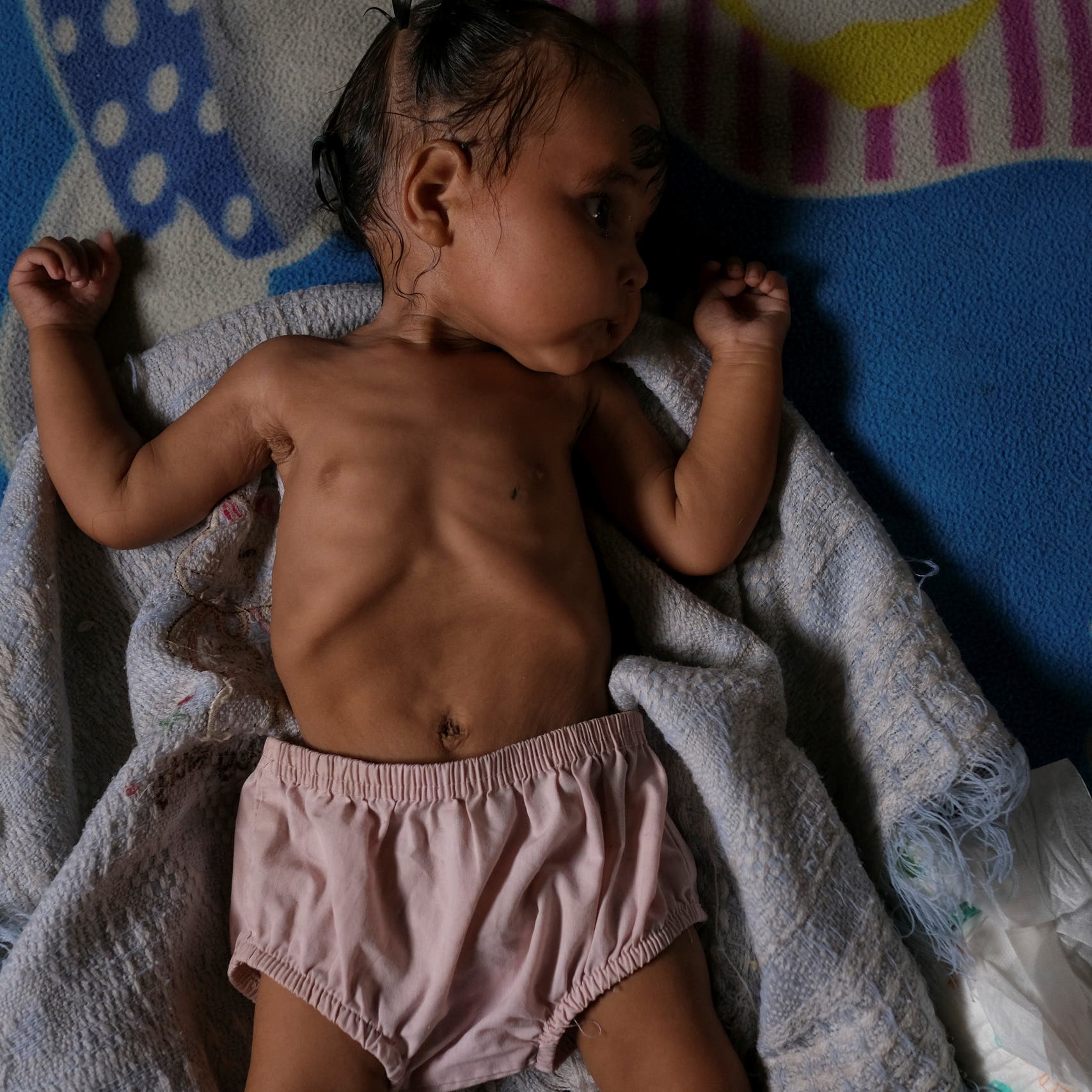 10 آلاف طفل قد يموتون شهريا من سوء التغذية نتيجة كورونا