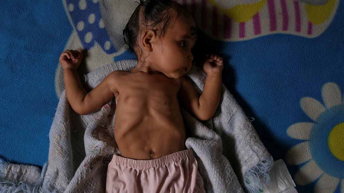 Sonia, seven moths old, who has diarrhoea and is underweight according to her mother, rests on a bed after bathing at her house in Barquisimeto, Venezuela August 16, 2019. She weighed 6 kilos and now weighs 5, she lost a kilo. Due to diarrhoea, she lost a kilo, what worries me is that she could also end up in a hospital, said Gregoria Hernandez, Sonia's mother, who has previously had two other children hospitalised for malnutrition. REUTERS/Carlos Garcia Rawlins SEARCH VENEZUELA MALNUTRITION FOR THIS STORY. SEARCH WIDER IMAGE FOR ALL STORIES.