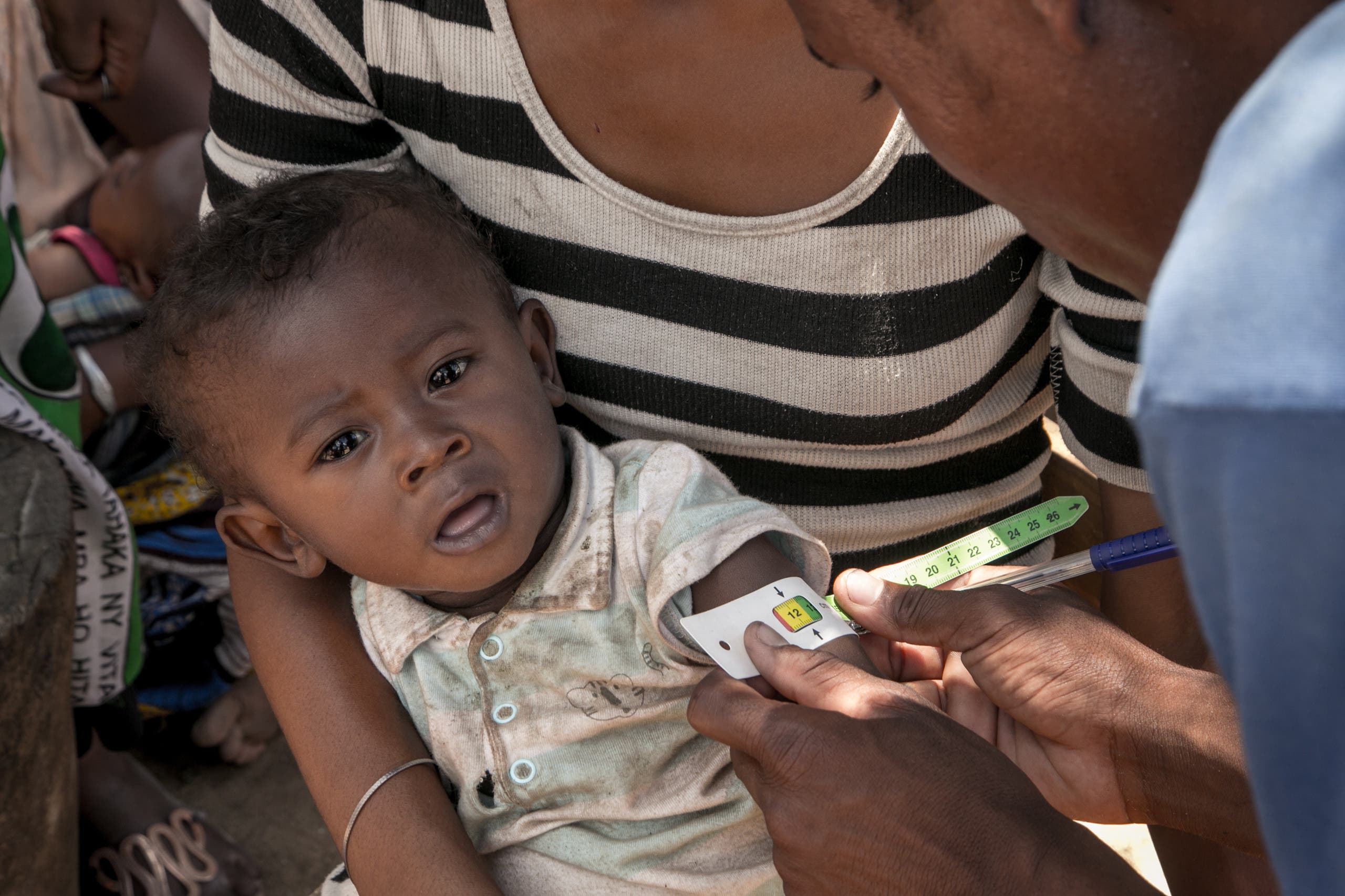 حملة في مدغشقر في 2018 للكشف عن حالات سوء التغذية بين الأطفال