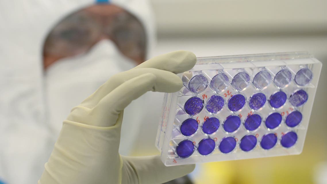 French engineer-virologist Thomas Mollet looks at 24 well plates adherent cells monolayer infected with a Sars-CoV-2 virus at the Biosafety level 3 laboratory (BSL3) of the Valneva SE Group headquarters in Saint-Herblain, near Nantes, western France, on July 30, 2020. Could the Covid-19 vaccine be found by a biotechnology company in western France, far from major global research centers? The hypothesis is more than plausible for the British government, which has just signed an important agreement with it.