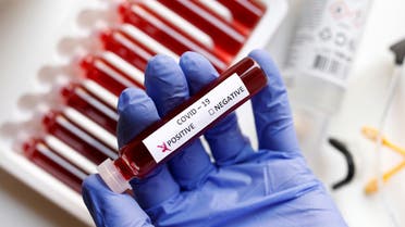 Fake blood is seen in test tubes labelled with the coronavirus (COVID-19) in this illustration taken March 17, 2020. (Reuters)