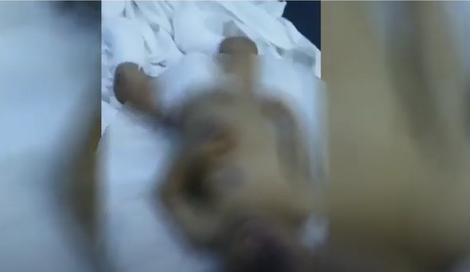  الطفل حسن عبده محمد في المستشفى