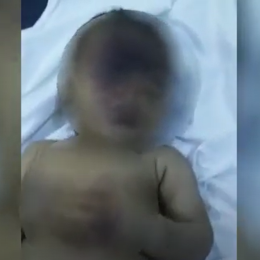 فيديو مؤلم.. طفل بعمر 4 أشهر ينضم لقائمة ضحايا مجزرة الحديدة