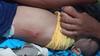 الحديدة.. إصابة طفل عمره عام واحد برصاص الحوثيين