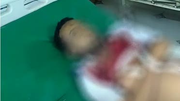 أحد ضحايا مجزرة مجمع إخوان ثابت في الحديدة 3 ديسمبر 2020