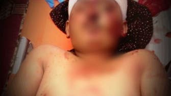  مقتل طفل يمني برصاص قناص حوثي في البيضاء