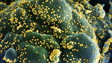A colorized scanning electron micrograph of an apoptotic cell (blue/green) heavily infected with SARS-COV-2 virus particles (yellow), isolated from a patient sample, captured at the NIAID Integrated Research Facility (IRF) in Fort Detrick, Maryland. (AFP)