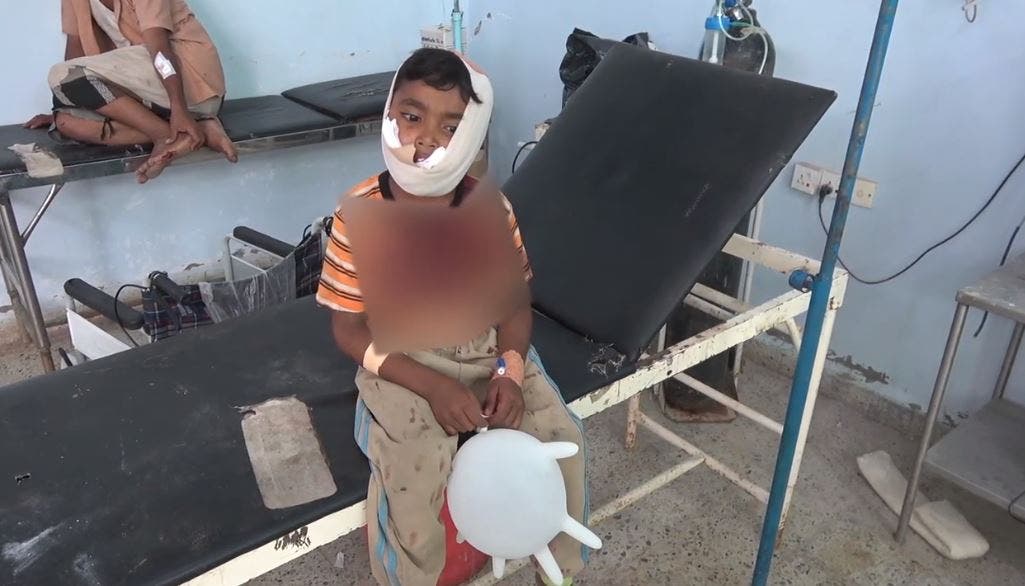 طفل مصاب من ضحايا الحرب في اليمن