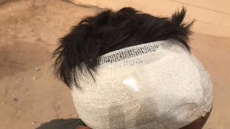 الریاض میں آوارہ کتوں کے حملے میں بچی کی موت کے بعد ایک بچہ زخمی