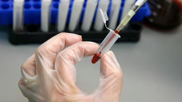 A file photo shows a laboratory technician examines blood samples for HIV/AIDS. (Reuters)