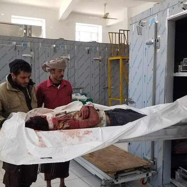 تعز.. قذيفة حوثية تستهدف كلية الآداب ومقتل وإصابة 6 مدنيين 