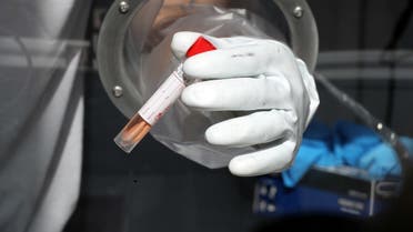 A man holds a swab sample as he demonstrates operating of the coronavirus disease checking system, at Ben Gurion International airport in Lod, Israel November 9, 2020. (Reuters/Ammar Awad)