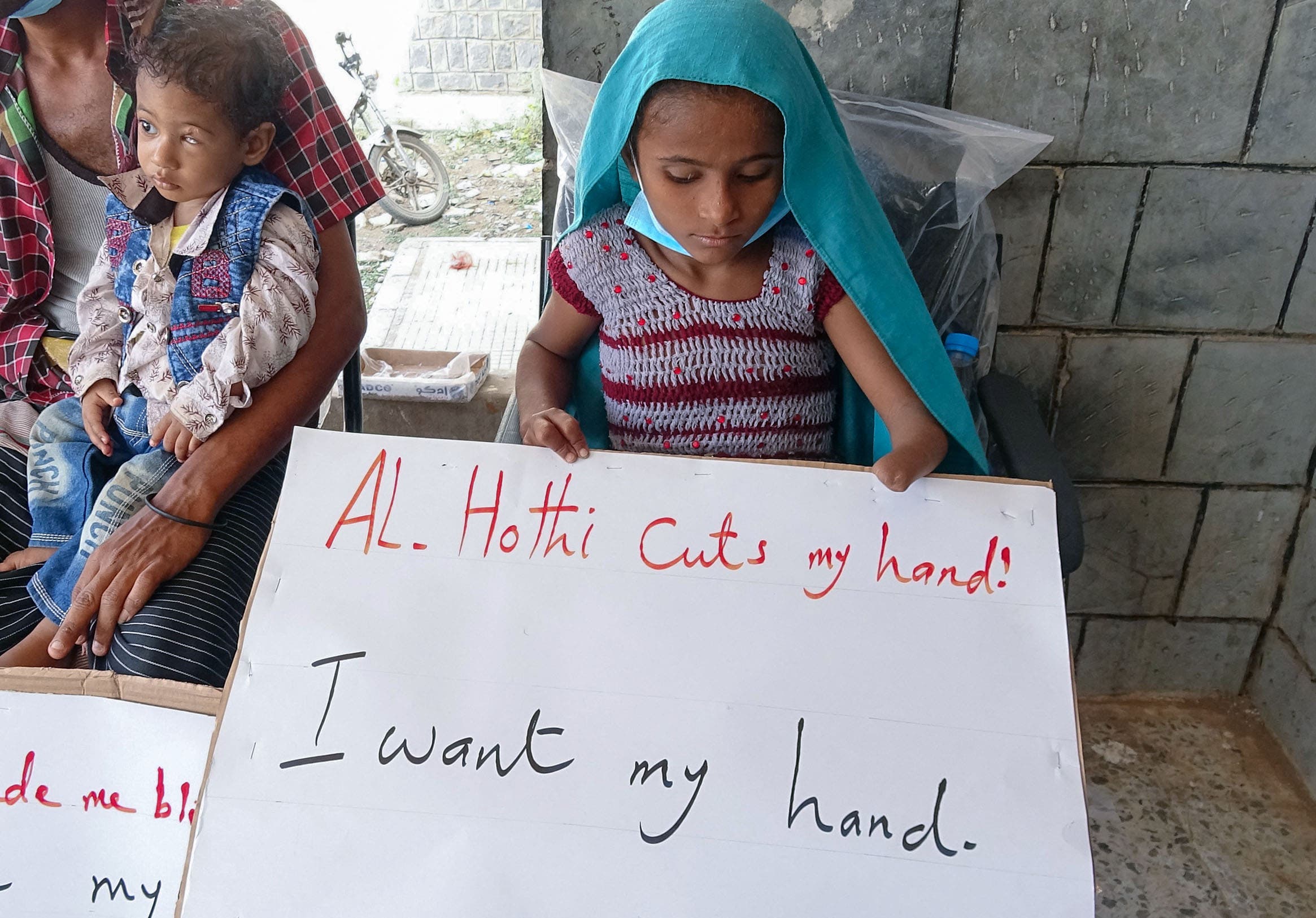 طفلة في حيس تشتكي خلال زيارة مسؤولة أممية من تسبب الحوثيين ببتر يدها (أرشيفية)