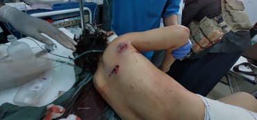 طفل أصيب جراء القصف الحوثي على حي سكني في مأرب
