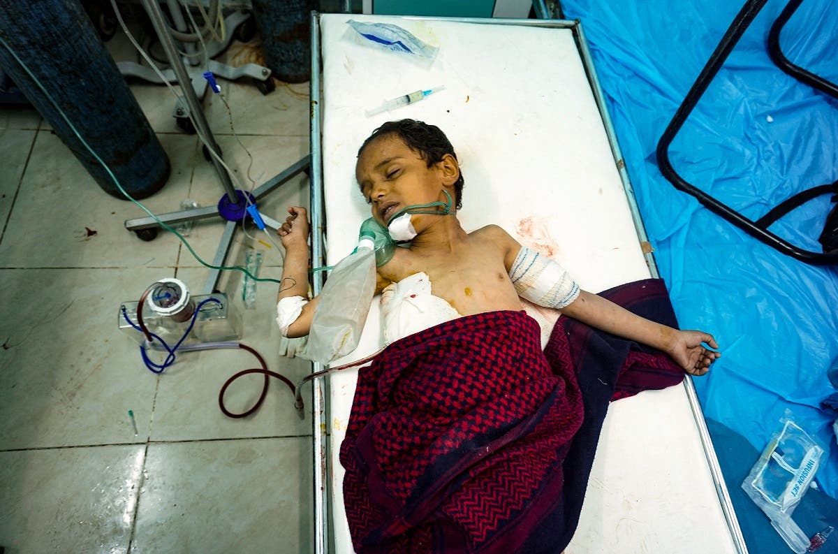 طفل يمني مصاب في مأرب إثر قصف للحوثيين في ابريل 2021