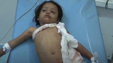 إصابة طفل بقذيفة حوثية