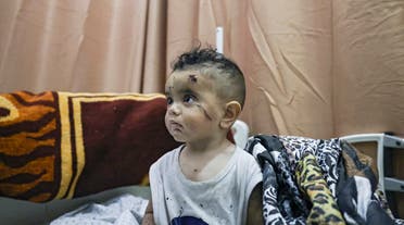 A Palestinian child, who was wounded in overnight Israeli air strikes on the Gaza Strip, receives treatment at Al-Shifa Hospital in the Palestinian enclave on May 16, 2021. (AFP)