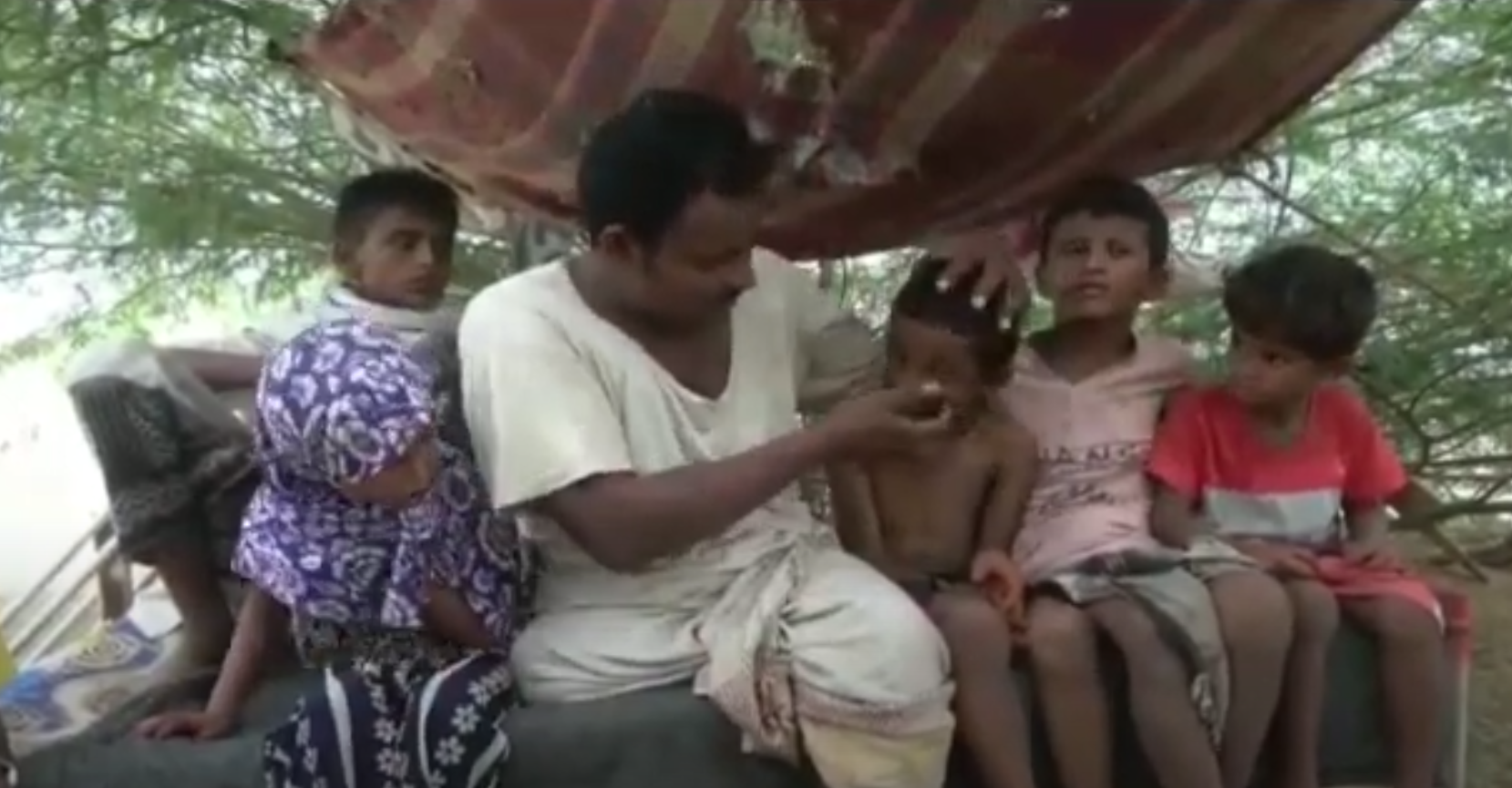 حسن يشير إلى ابنه الذي فقد الرؤية في إحدى عينيه بسبب اللغم الحوثي