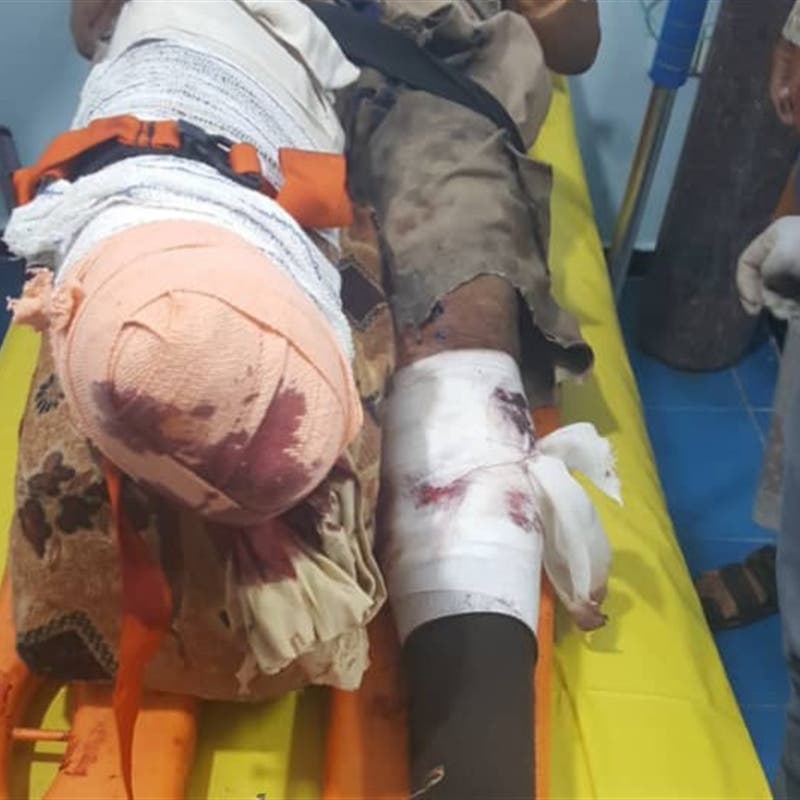 إصابة مهندس في "مسام" بانفجار لغم حوثي أثناء عمله