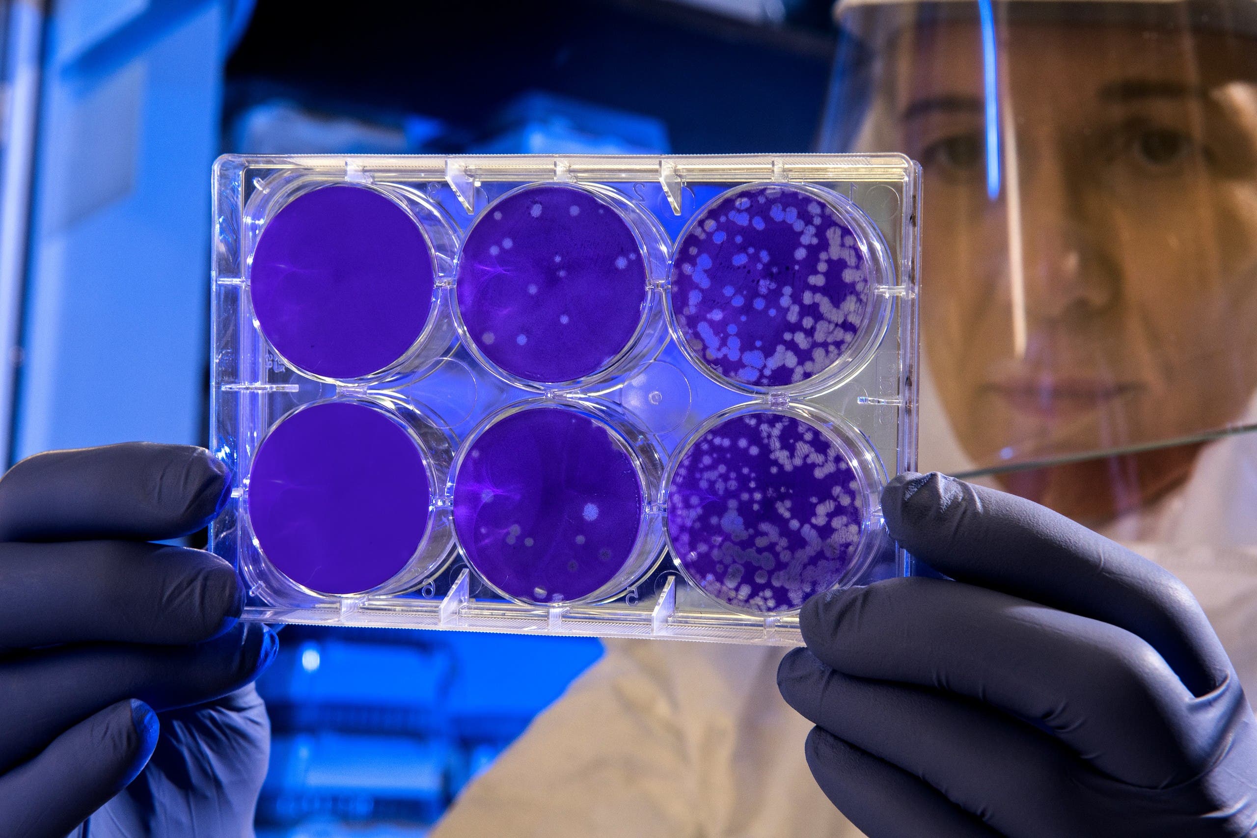 Scientist in a lab. (Unsplash, CDC)