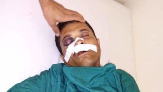 اليمن.. عبوات ناسفة حوثية تقتل 3 مدنيين وتجرح العشرات
