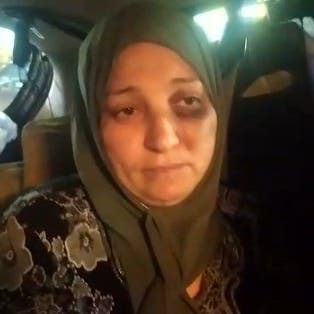 11 غرزة في الرأس وكدمات.. المصرية ضحية الجزار تروي تفاصيل الواقعة