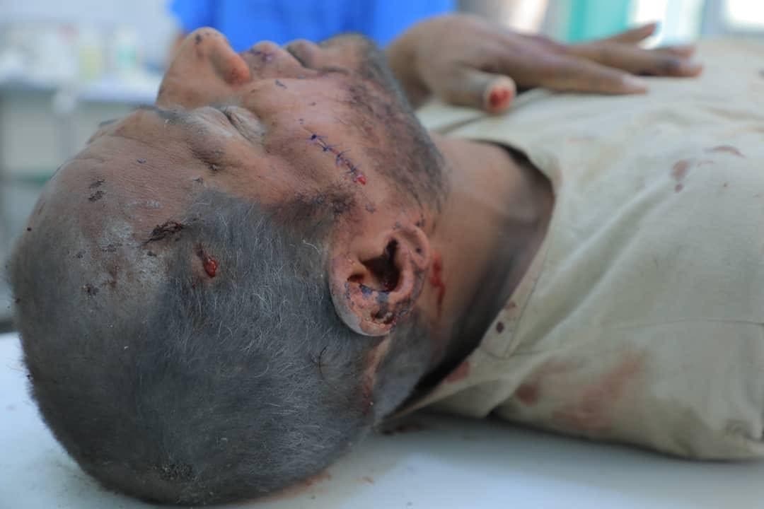 من ضحايا الهجوم الحوثي على مأرب