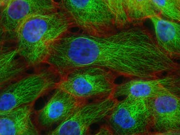 Stress Fibers and Microtubules in Human Breast Cancer Cells. Created by Christina Stuelten, Carole Parent, 2011. (Unsplash, National Cancer Institute)