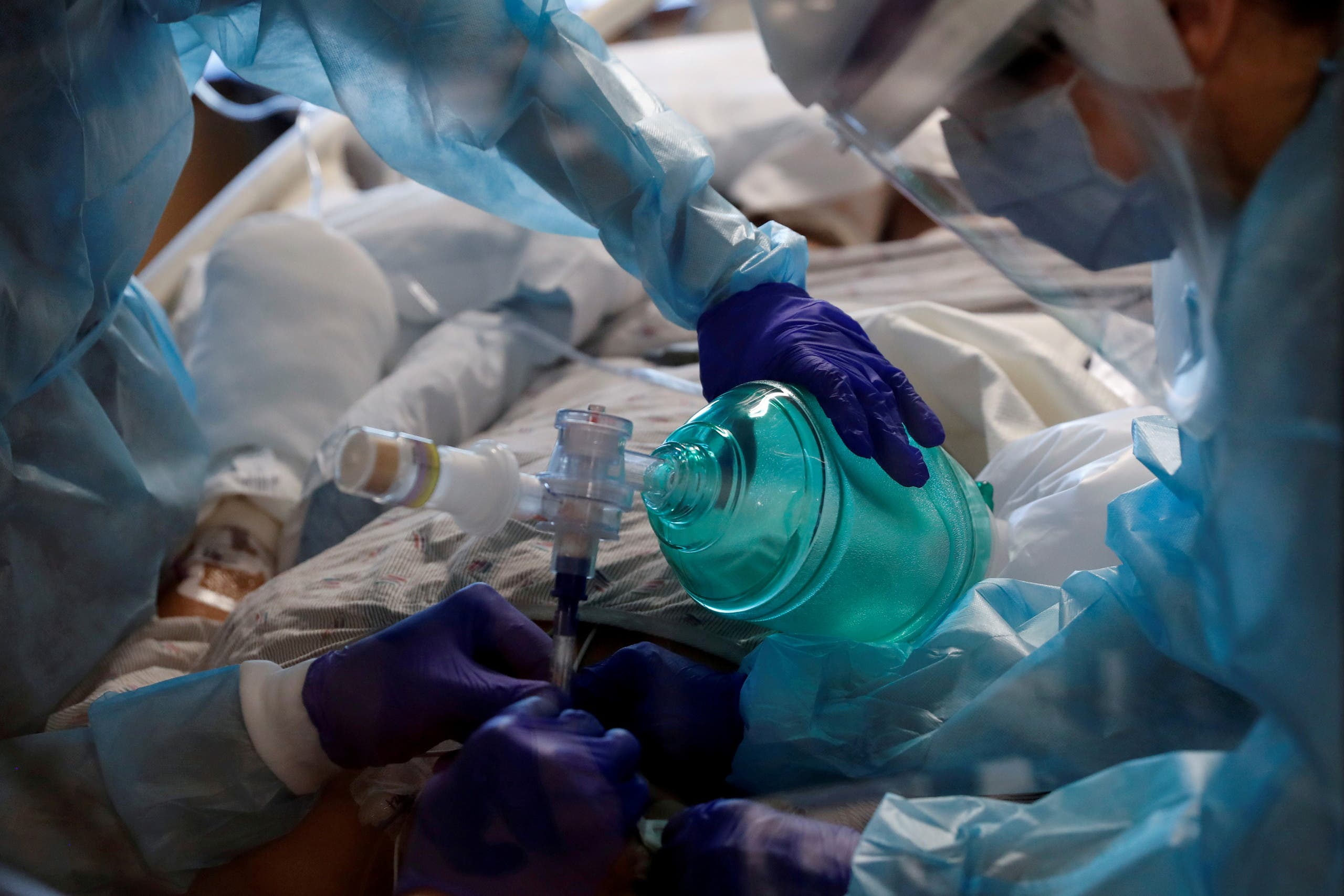 Critical care workers insert an endotracheal tube into a coronavirus disease (COVID-19) positive patient in the intensive care unit (ICU) at Sarasota Memorial Hospital in Sarasota, Florida, February 11, 2021. (Reuters)