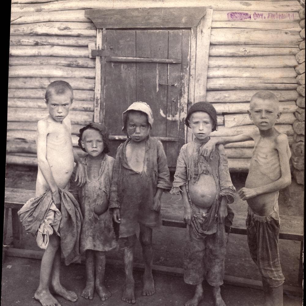 A photo of children suffering from malnutrition in Russia during the famine