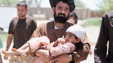 طفل أفغاني من ضحايا الحرب