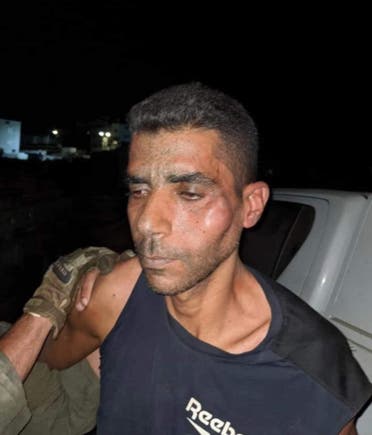 صورة تظهر اثار الاعتداء الذي تعرض له الاسير زكريا الزبيدي خلال اعتقاله