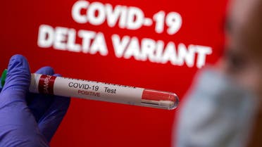  A person holds a test tube labelled 'COVID-19 Test Positive' in front of displayed words 'COVID-19 Delta variant' in this illustration taken August 31, 2021. (Reuters)