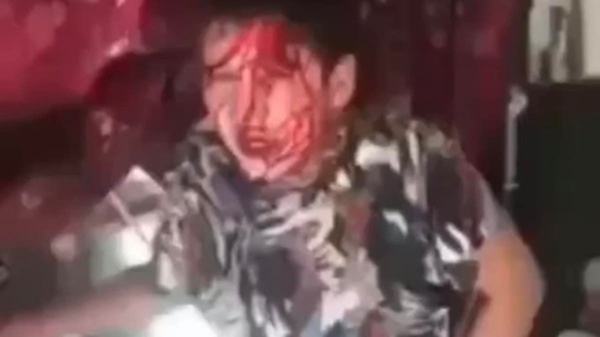 "بابا اقتلني" صرخة تفطر القلوب.. طفل معنف يطلب الموت لإنهاء معاناته