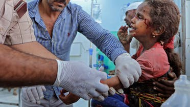 طفلة مصابة جراء هجوم الحوثي على مأرب يوم 3 أكتوبر 2021 (فرانس برس)