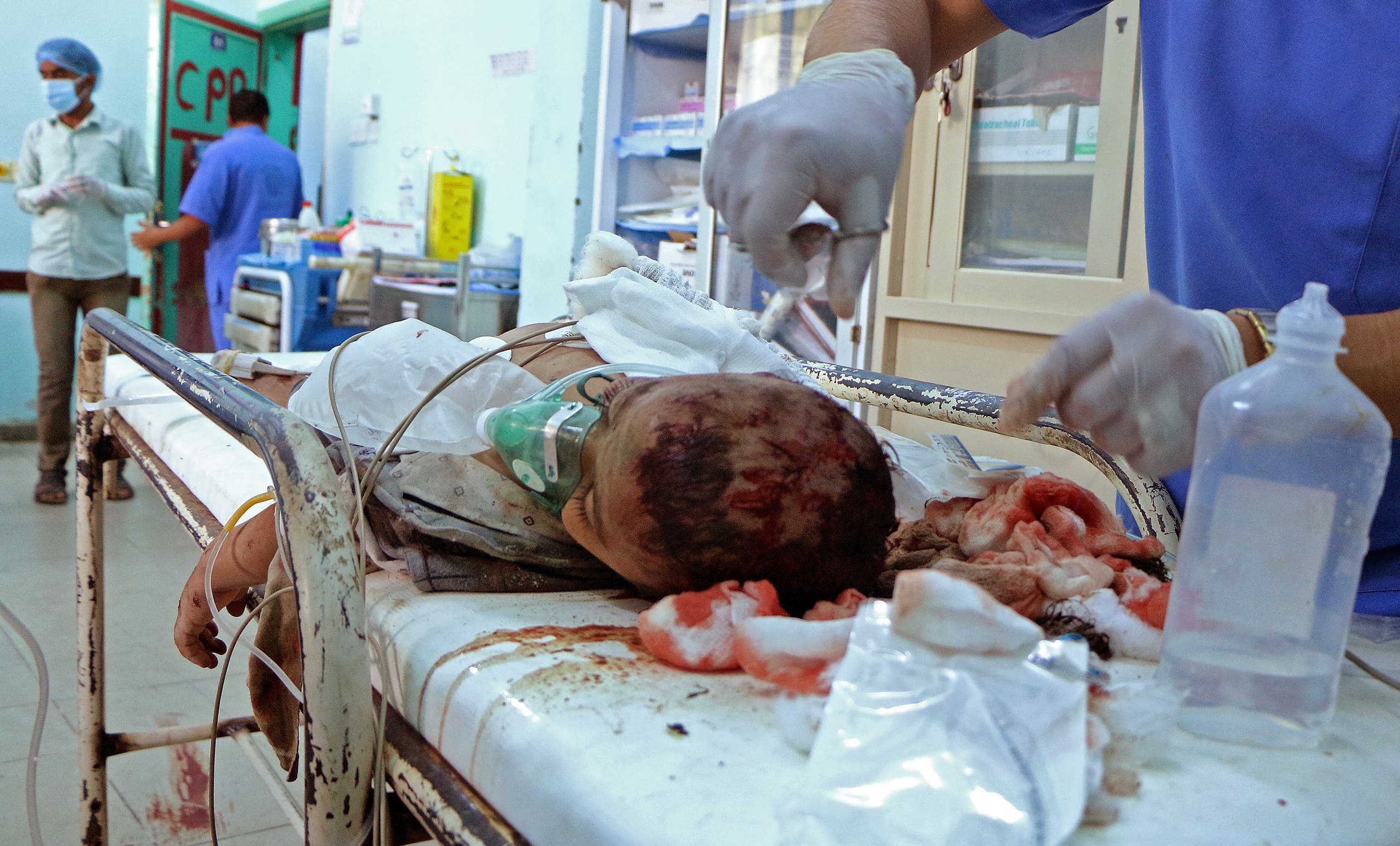 طفل مصاب جراء هجوم الحوثي على مأرب يوم 3 أكتوبر 2021 (فرانس برس)