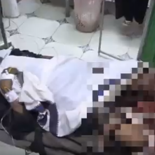 بتر ساقي امرأة حامل في الحديدة.. بسبب لغم حوثي