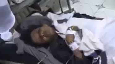 امرأة حامل تدعى محمـدة محمد جلاجل أصيبت بجروح بليغة منها بتر أطرافها السفلية بانفجار لغم للحوثيين