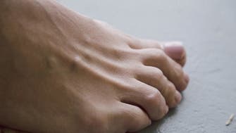 Scientists pinpoint reasons behind ‘COVID toe’ condition