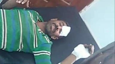اليمن.. ألغام الحوثيين تصيب 6 مدنيين في مأرب والجوف